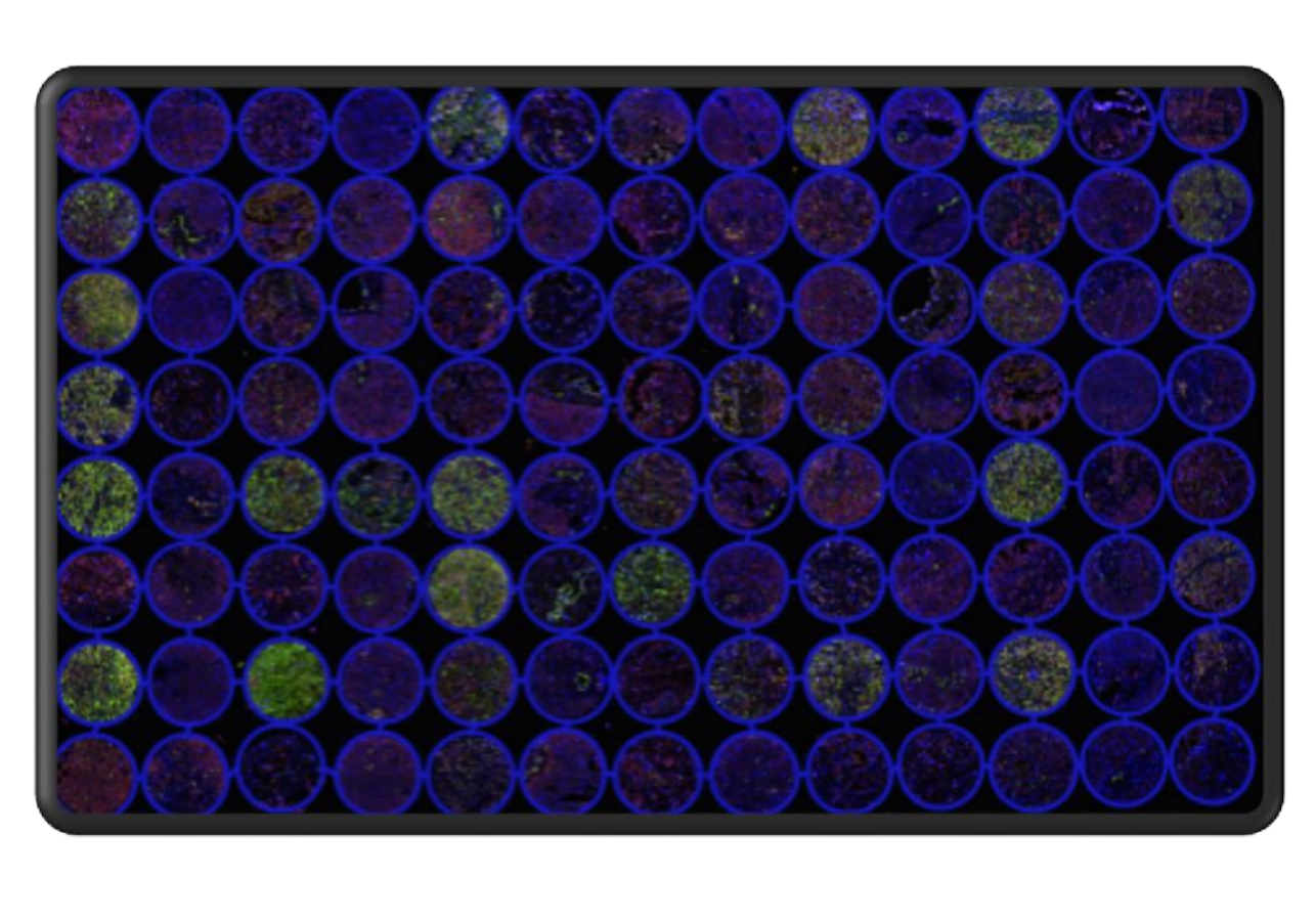 Tissue microenvironment analysis